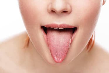 ④舌痛症・ドライマウス