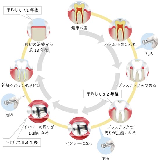 お口の健康を守ります～予防歯科～